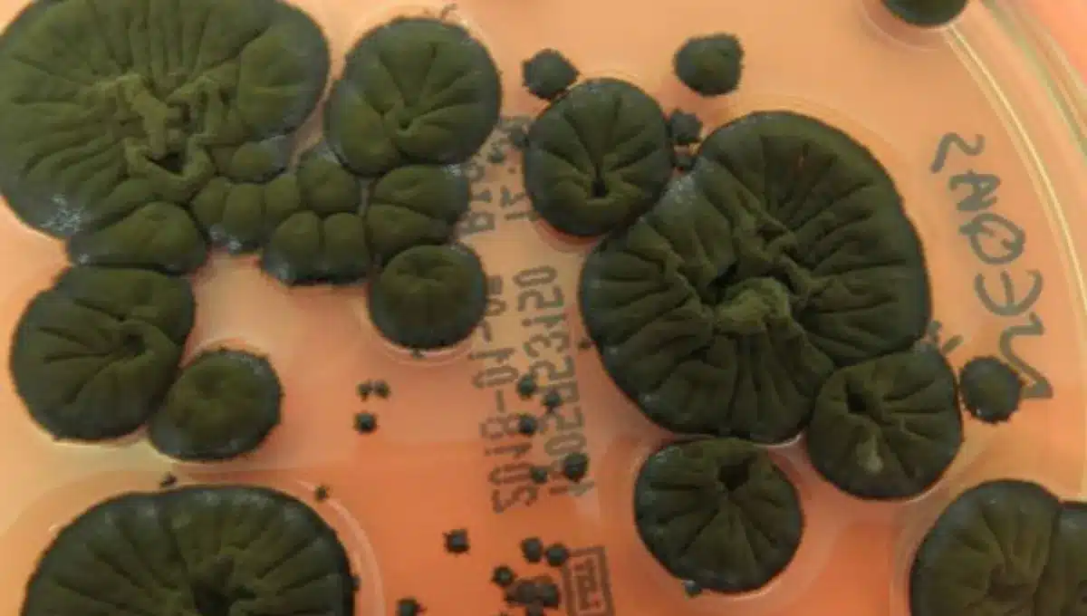 Mystery Deepens Around Chernobyl’s Radiation-Loving Black Fungus: Is It Really “Eating” Radiation?